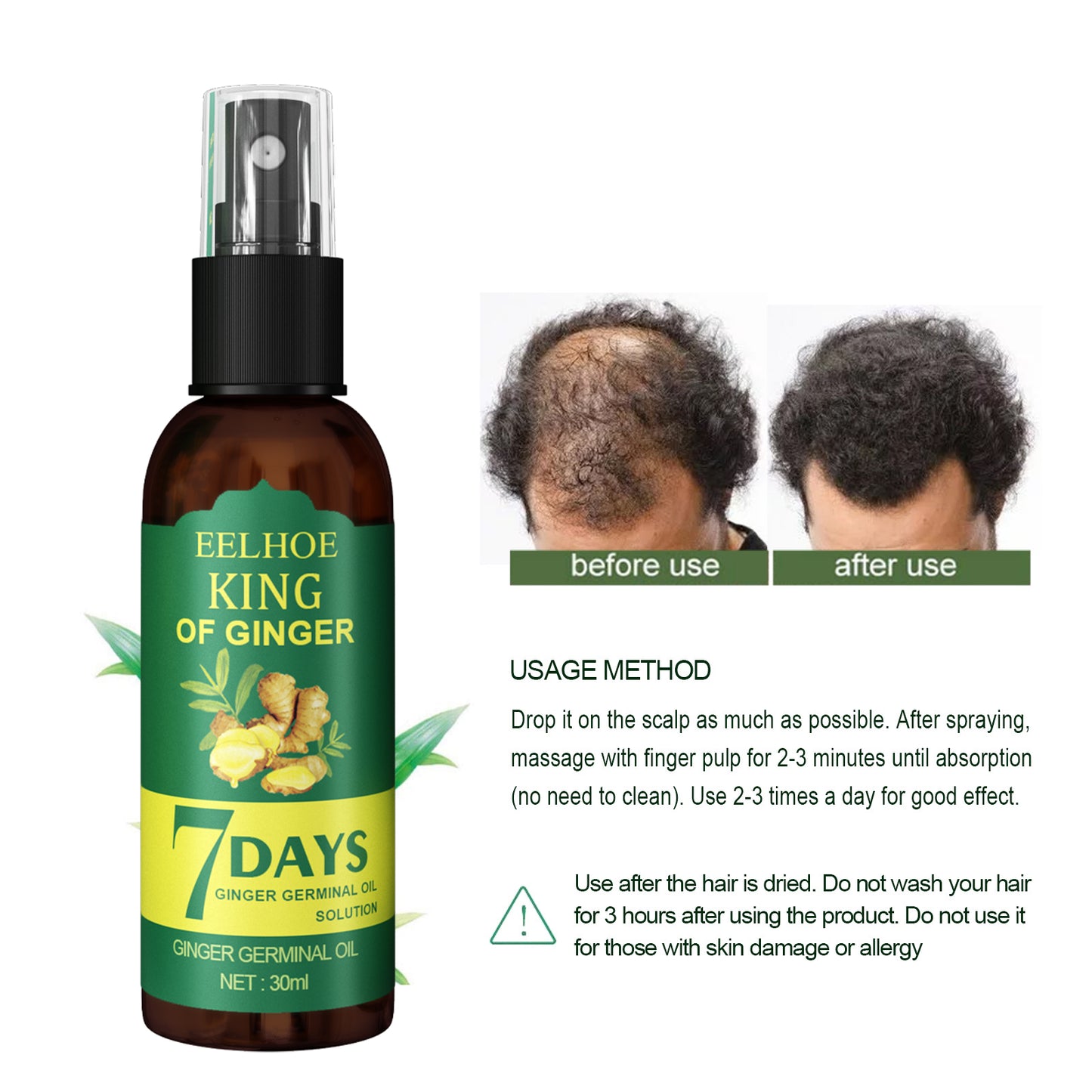 EELEelhoe Ginger Hair Spray, Strengthens Hair, Massages Scalp And Restores Hair