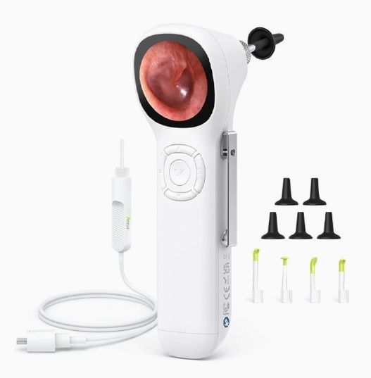 Digital Smart Otoscope With Magnification And A Detachable Extension