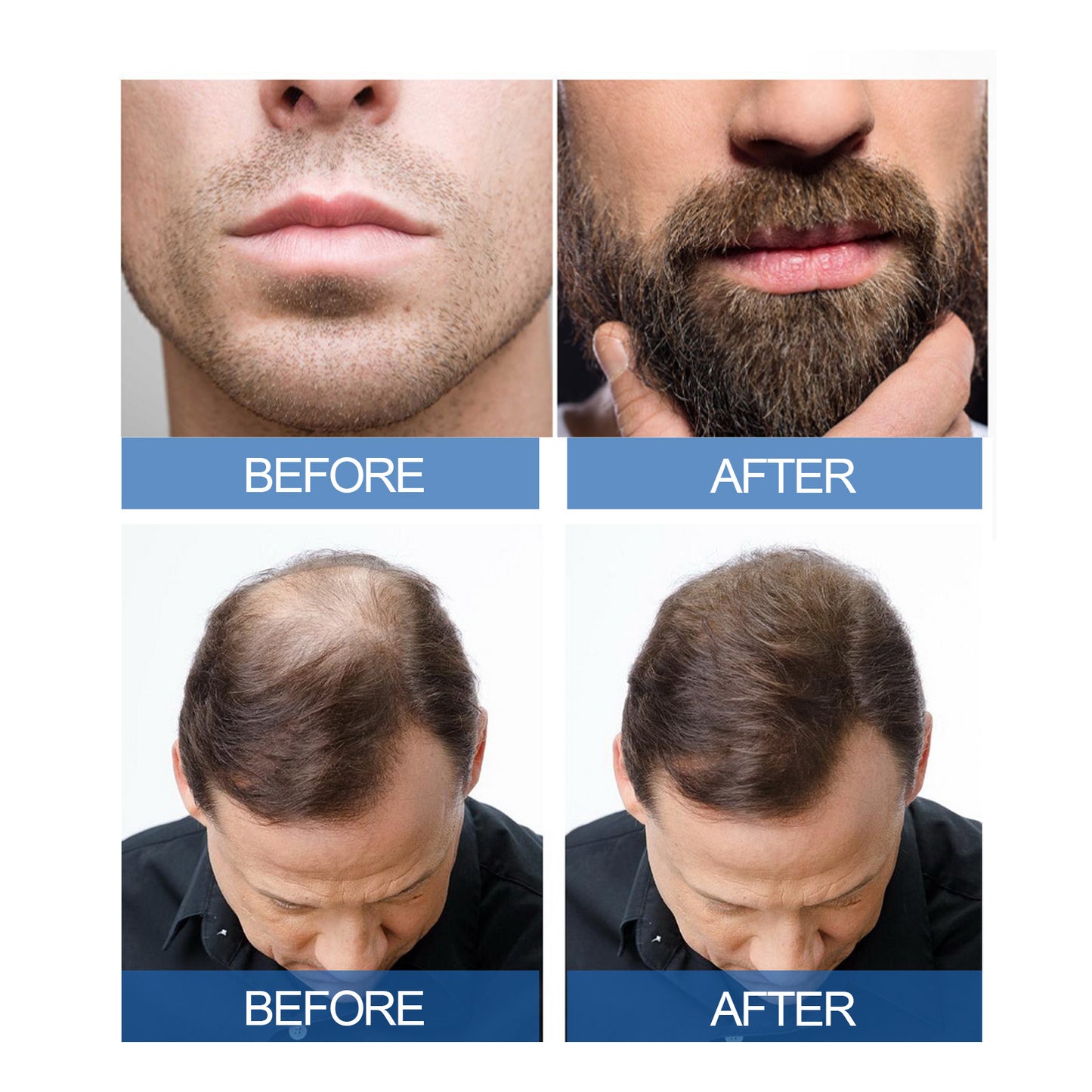 East Moon Men's Hair Treatment Liquid Hair Treatment For Men's Thick And Solid Hair
