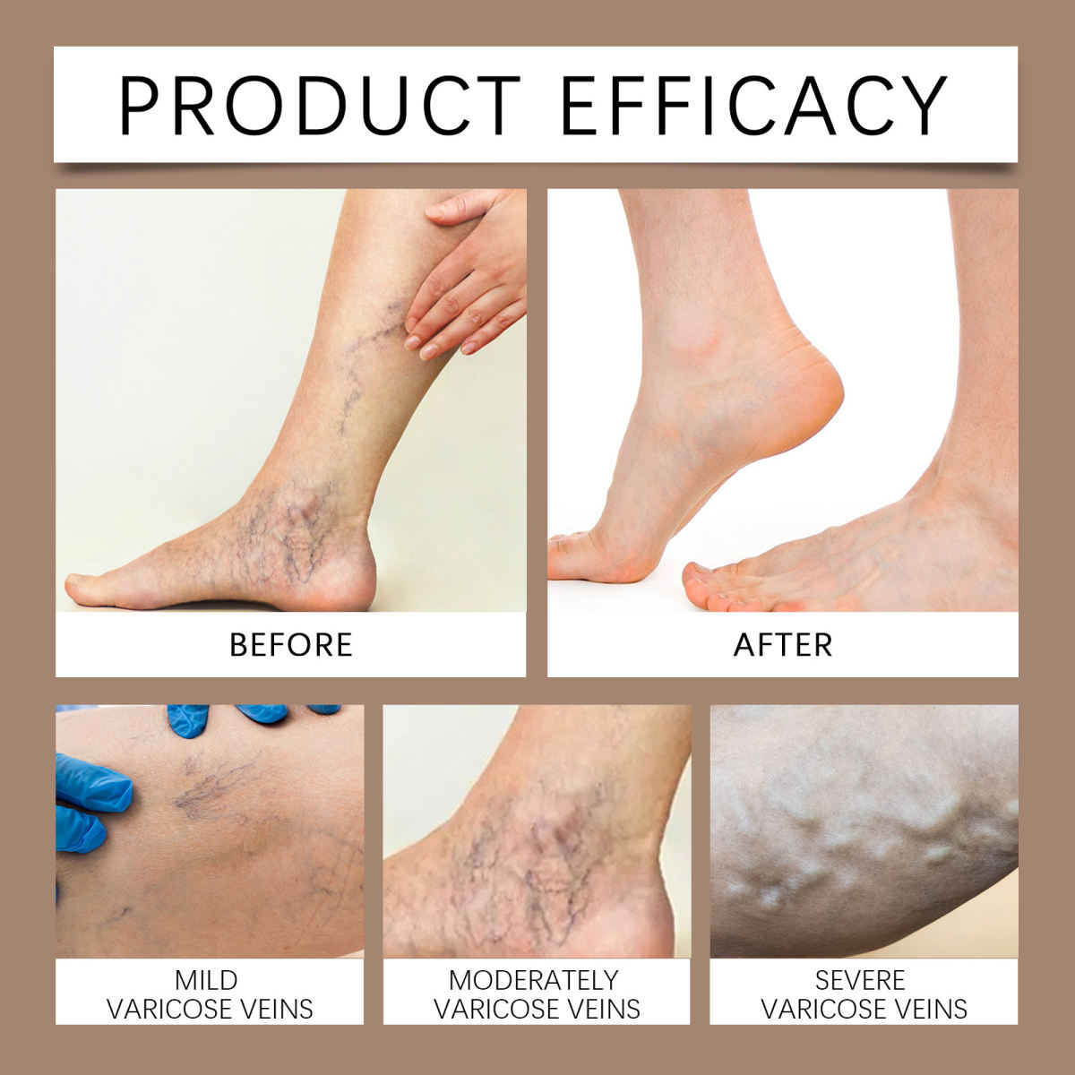 Moisturizing Leg Skin Gentle Care Leg Massage Neck Cream