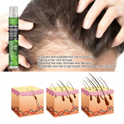 South Moon Hair Growth Serums, Hair Anti-Drop Liquid Hairline Thick Hair Herbal Essential Oil