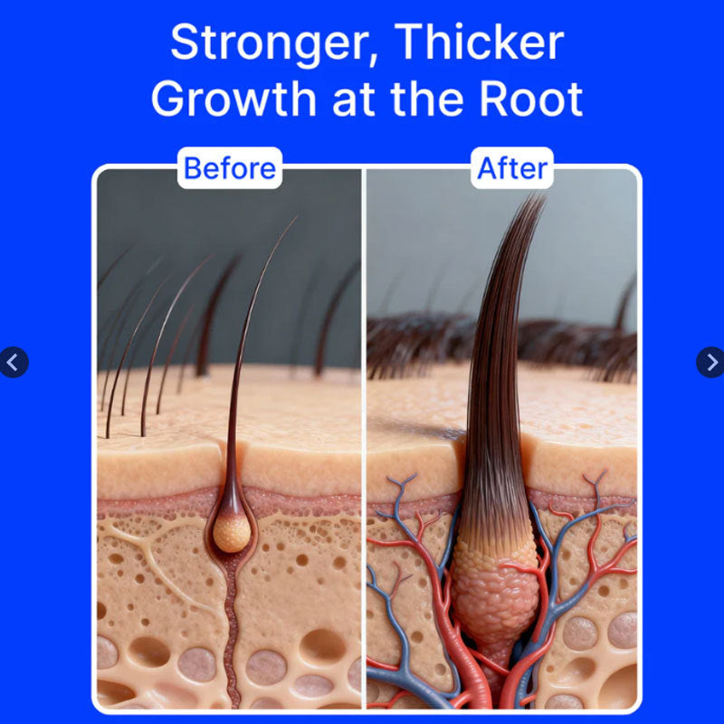 Hair Growth Microneedle Solution For Hair Regeneration