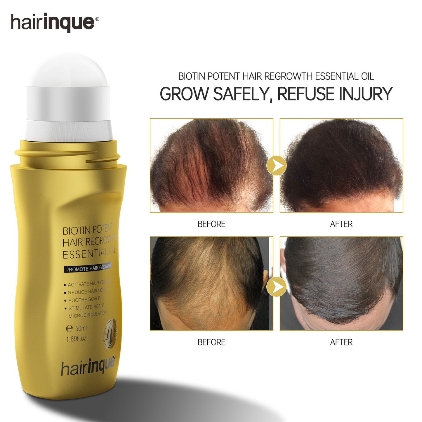 Fluffy Hair-Nourishing And Hair-Caring Convenient Essential Oil