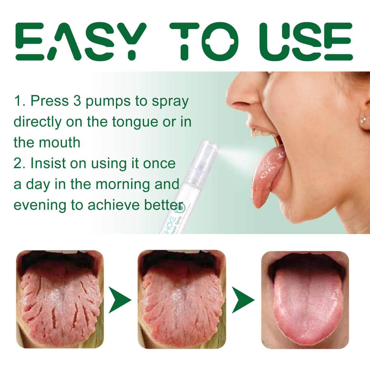 Curing Tongue Coating Whitening Relieving Tongue Cracking Swelling Oral Care Spray