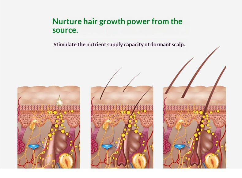 Herbal Hair-loss Prevention And Growth Tonic For Nourishing
