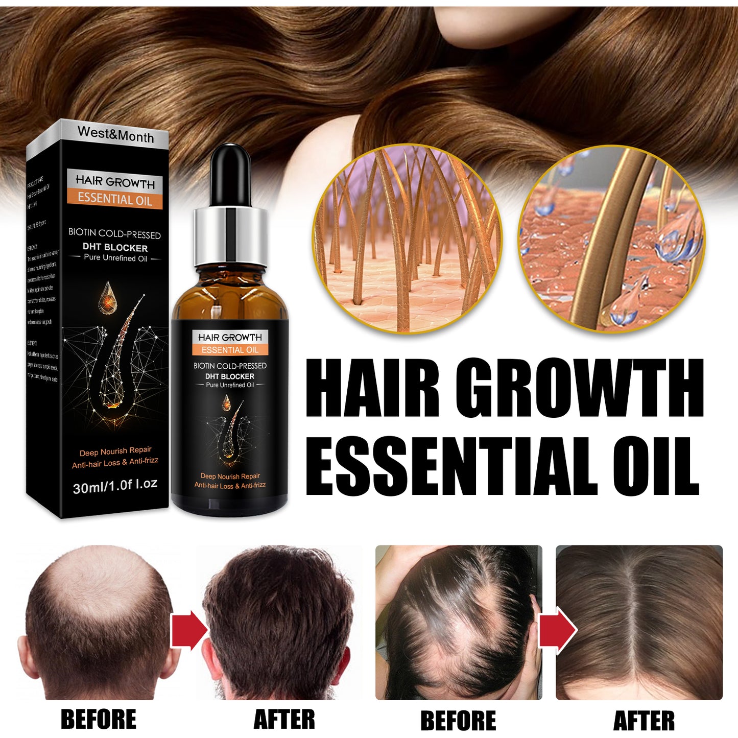 West&Month Hair Growth Essential Oil, Dense Hair Growth Repair Dry Hair And Moisture Hair Essence