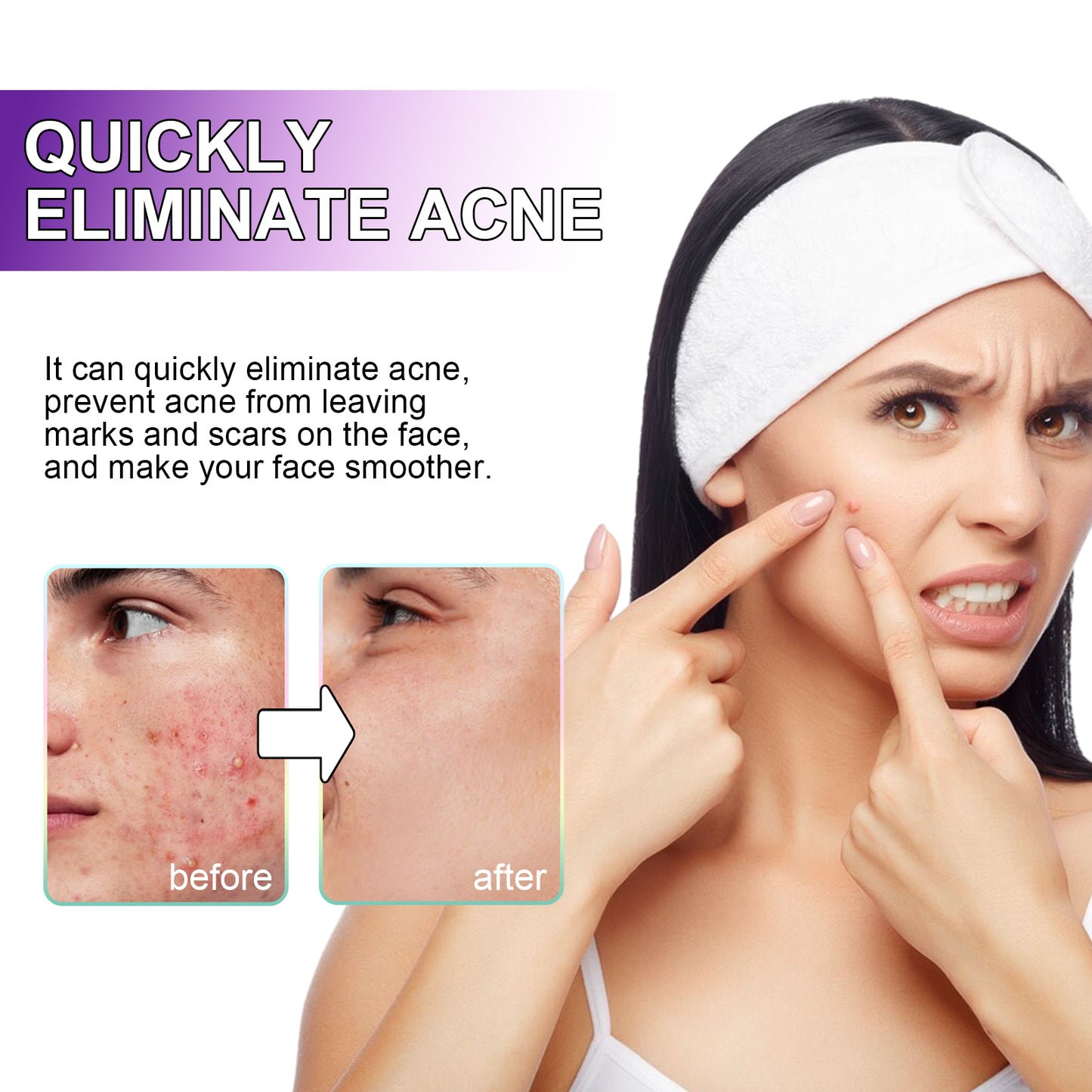 Jaysuing Acne Patches, Lightening Facial Acne Pimples Closed Repair Balance Skin Delicate Pore Care