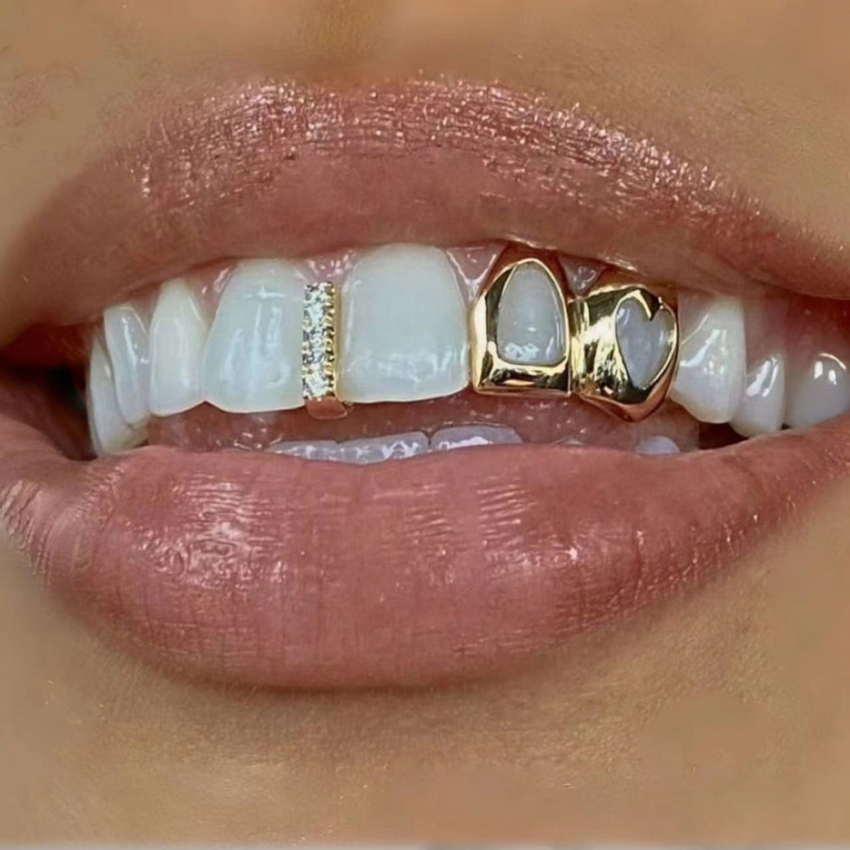 Hollow-out Love Double Fight Tooth Socket Daily Street Dazzling Accessories