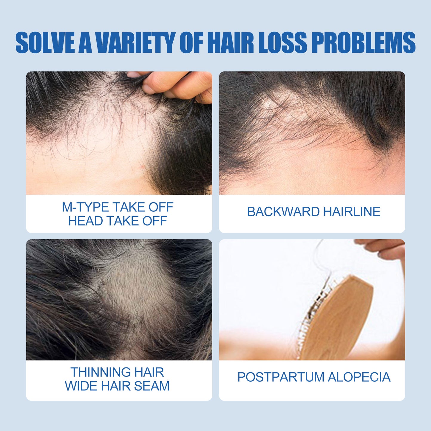 East Moon Men's Hair Treatment Liquid Hair Treatment For Men's Thick And Solid Hair