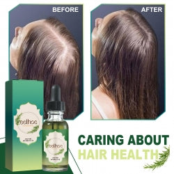EELHOE Hair-Serum Oil, Nourish The Scalp Hair Loss Prevention Dense Moist Strong Hair, Protect Hair Oil