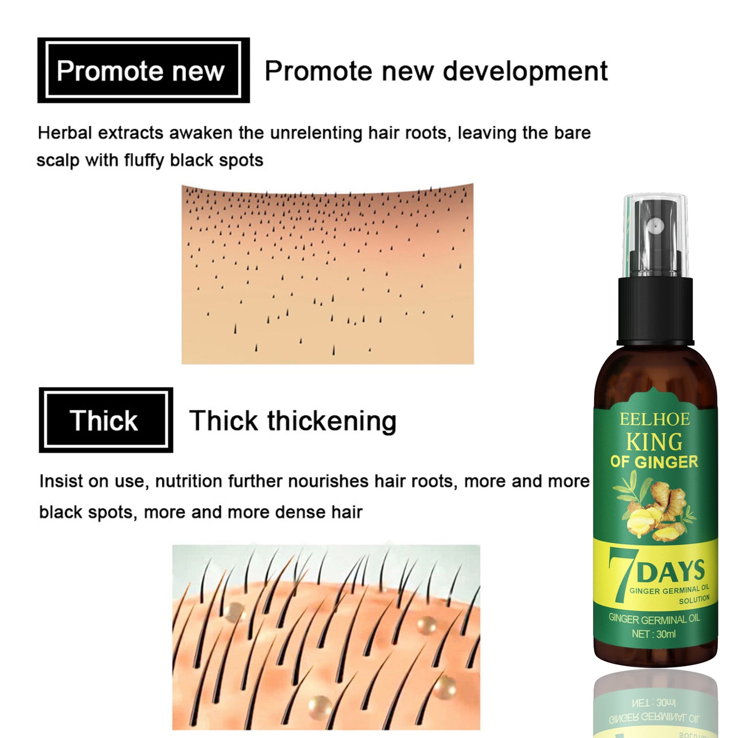 EELEelhoe Ginger Hair Spray, Strengthens Hair, Massages Scalp And Restores Hair