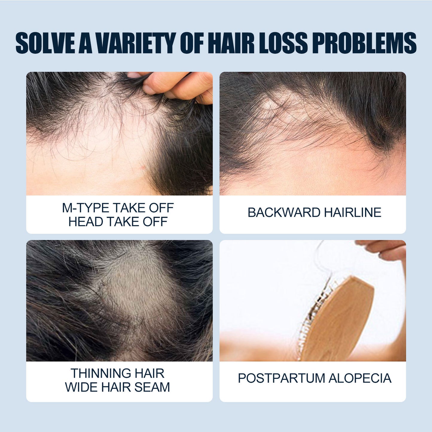 East Moon Men's Hair Spray, Dense Hair Solid Hair Hair Line Anti-Drop Treatment Fluid Thick