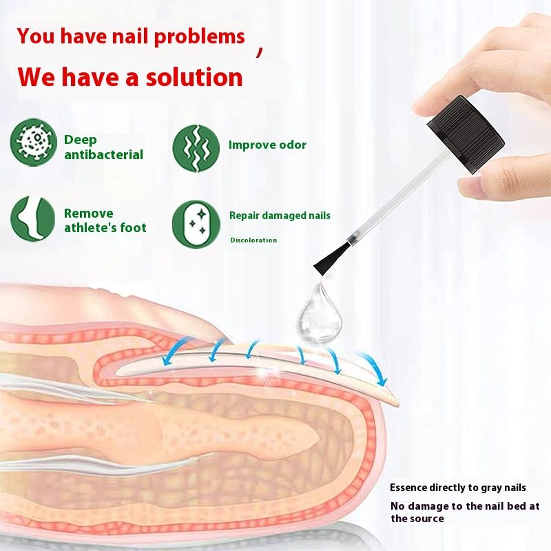 Household Nail Care Solution 30ml Glass Bottle