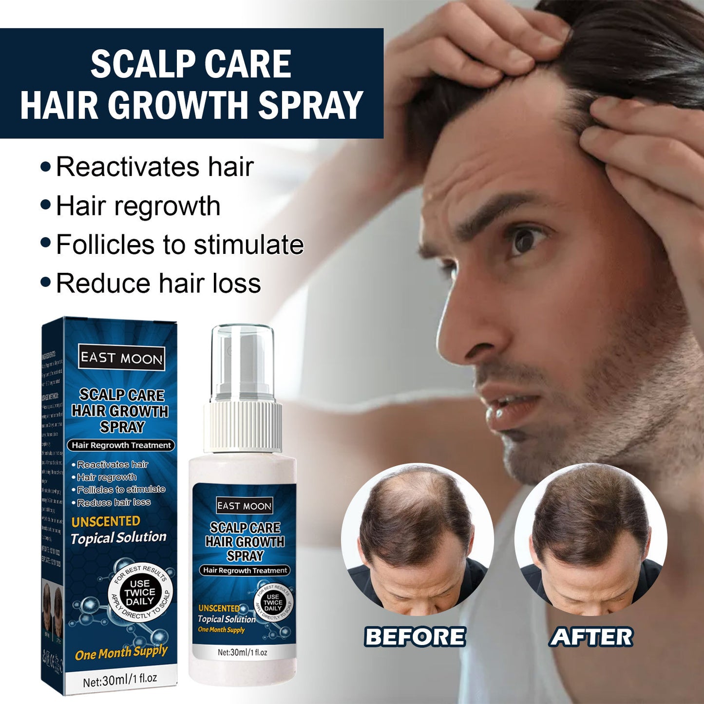 East Moon Men's Hair Spray, Dense Hair Solid Hair Hair Line Anti-Drop Treatment Fluid Thick