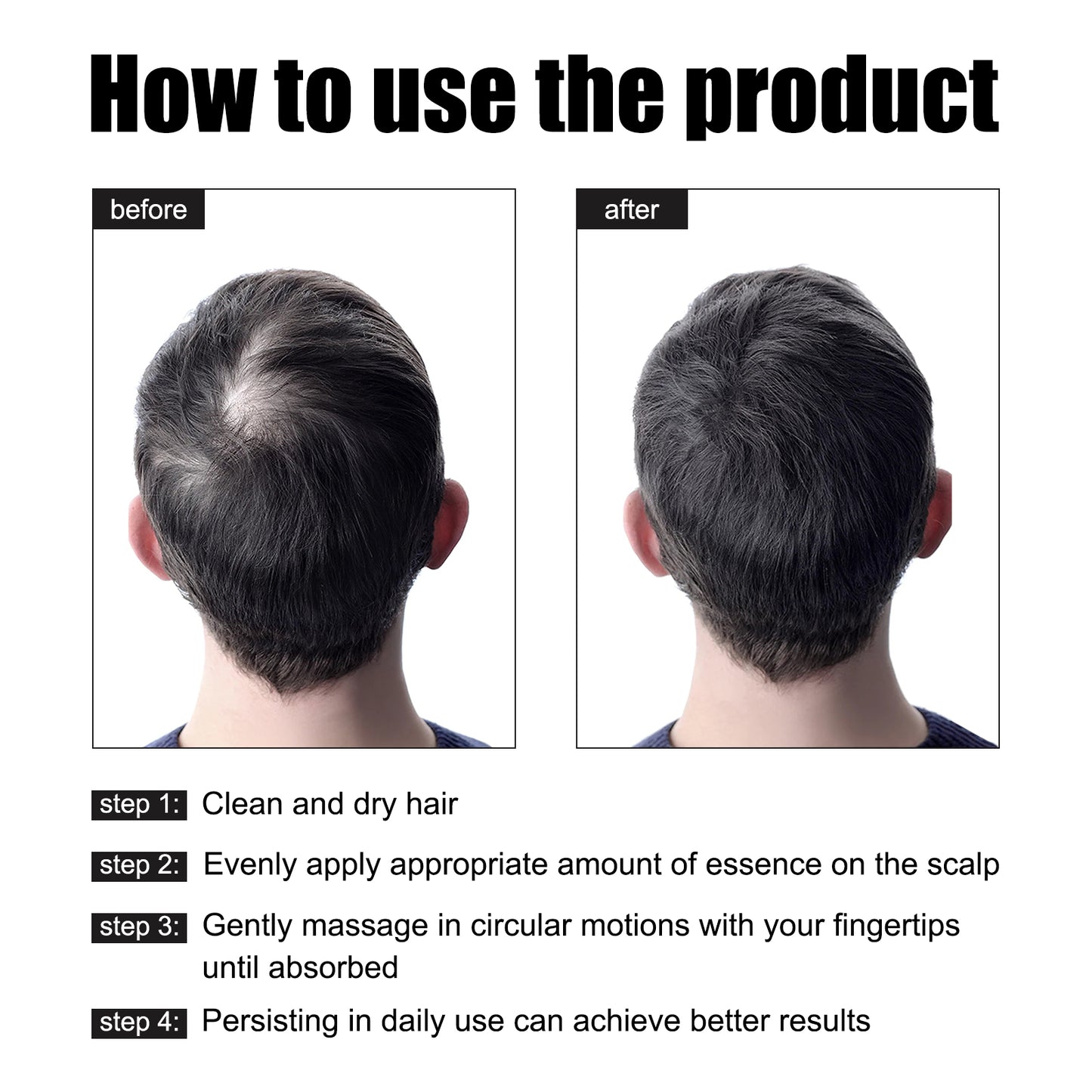 Men's Hair Thickening Serum 10.6X3.2X3.1