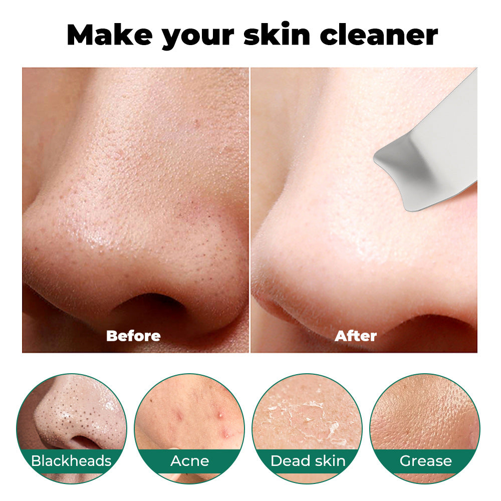Ultrasonic Blackhead Removal Machine Import And Export Beauty Device
