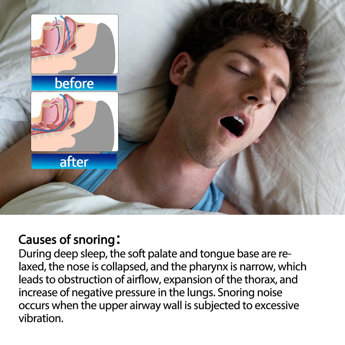 Snoring Stop Sleep Improvement Care Patch