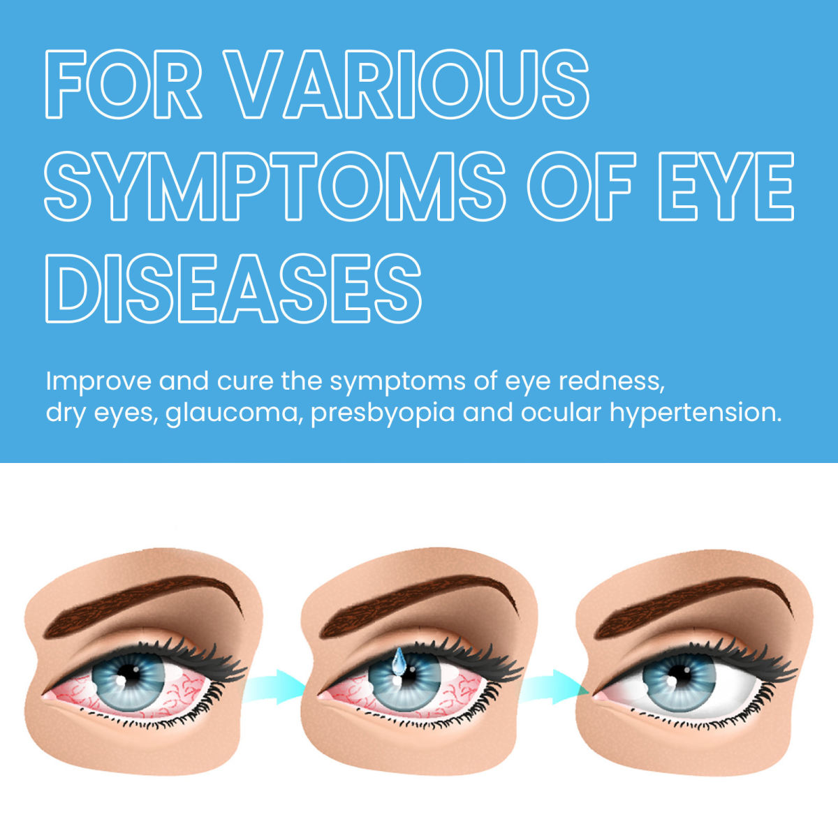 Eye Gentle Moisturizing And Fatigue Eye Care Eye Drops