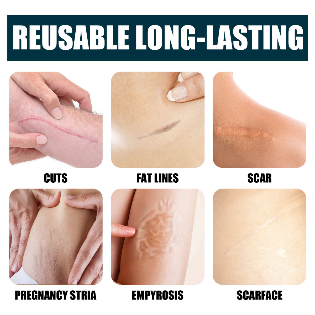 Skin Repair Moisturizing Skincare Cream