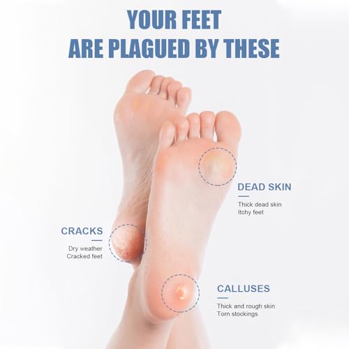 1 pc Pedicure Tools, Stainless Steel Foot Tools and spatulas to Meet The Pedicure Needs of Men and Women