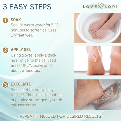 Callus Remover for Feet (Extra Strength) Foot Callus Remover Gel - Pedicure Tools for Feet Scrubber – Foot Care Spa Essent...