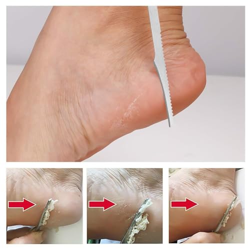 1 pc Pedicure Tools, Stainless Steel Foot Tools and spatulas to Meet The Pedicure Needs of Men and Women