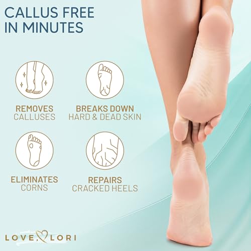 Callus Remover for Feet (Extra Strength) Foot Callus Remover Gel - Pedicure Tools for Feet Scrubber – Foot Care Spa Essent...