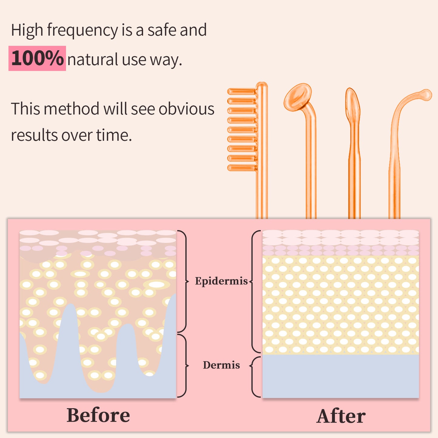 Home Electrotherapy Beauty Instrument High Frequency