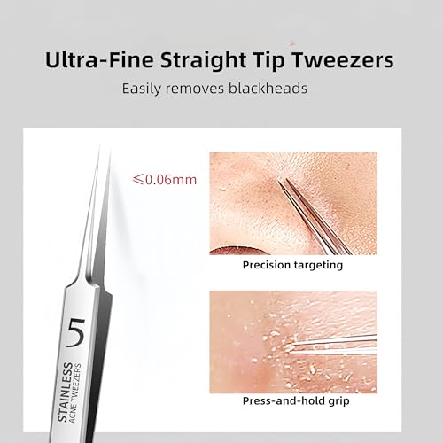 3 Pieces Removal Blackhead Tweezers Precision,Stainless Steel Extractor Acne Removal Kit Pimple Popper Tool, Clip for Whit...