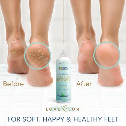 Callus Remover for Feet (Extra Strength) Foot Callus Remover Gel - Pedicure Tools for Feet Scrubber – Foot Care Spa Essent...
