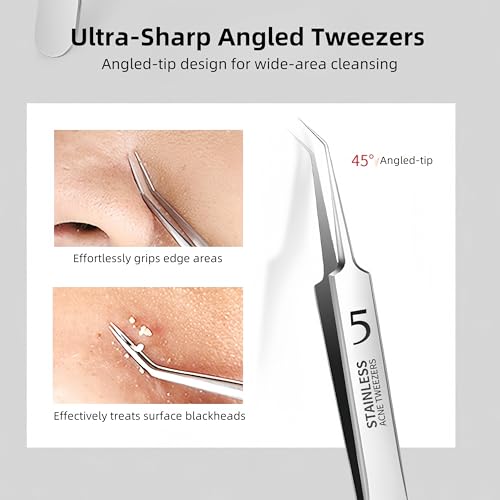 3 Pieces Removal Blackhead Tweezers Precision,Stainless Steel Extractor Acne Removal Kit Pimple Popper Tool, Clip for Whit...