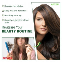 EELHOE Hair-Serum Oil, Nourish The Scalp Hair Loss Prevention Dense Moist Strong Hair, Protect Hair Oil