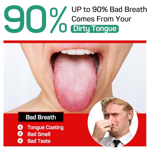 RONAVO Tongue Scraper for Adults (3 Pack), Reduce Bad Breath, Metal Tongue Scraper, Easy to use & Clean, with Travel Case ...