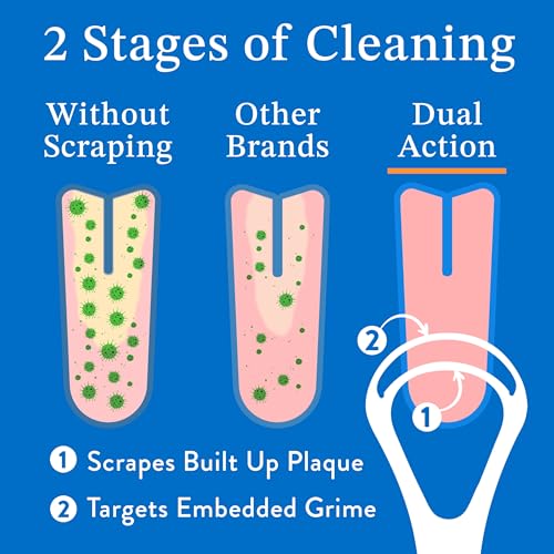 Mouthology Tongue Scraper for Adults (2 Pack), Reduce Bad Breath, Metal Tongue Scraper, Tongue Cleaner, Tongue Scraper, St...
