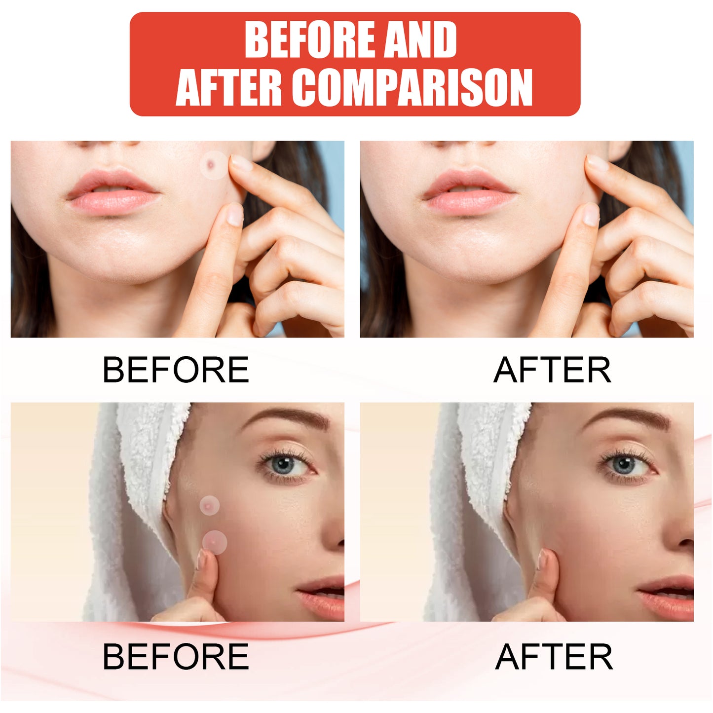 EELHOE Hydrocolloid Acne Patch, Facial Invisible Makeup Clean Acne Waterproof Breathable Acne Muscle Repair Patch