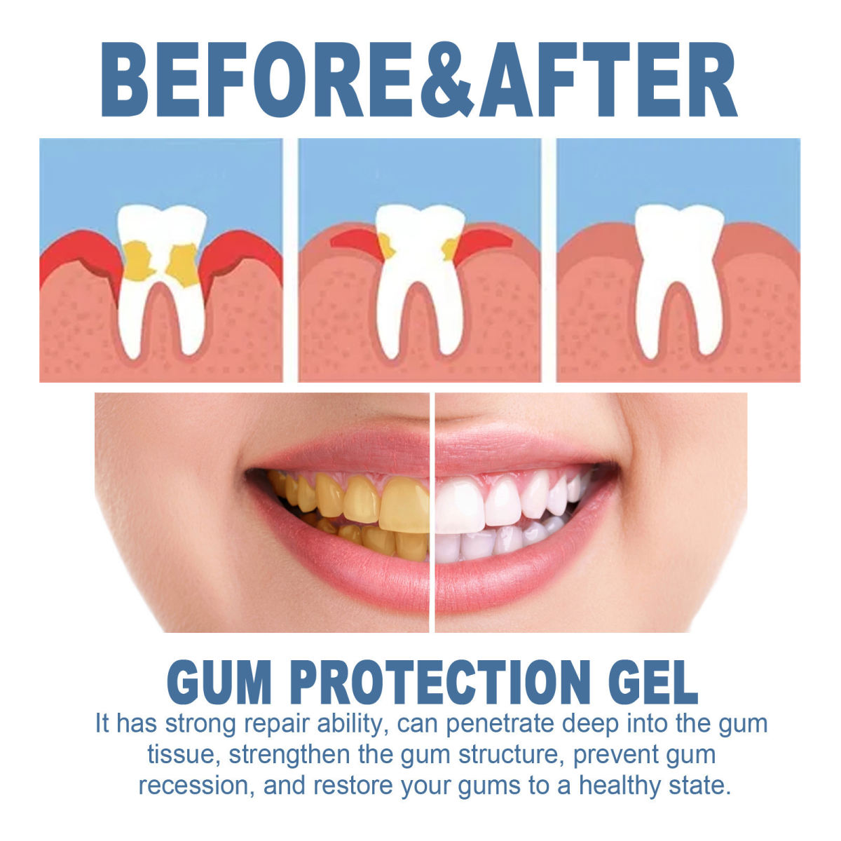 Tooth Repair Gel Cleaning And Whitening Care Toothbrush
