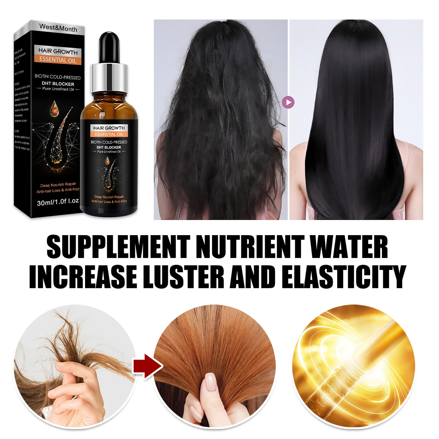 West&Month Hair Growth Essential Oil, Dense Hair Growth Repair Dry Hair And Moisture Hair Essence