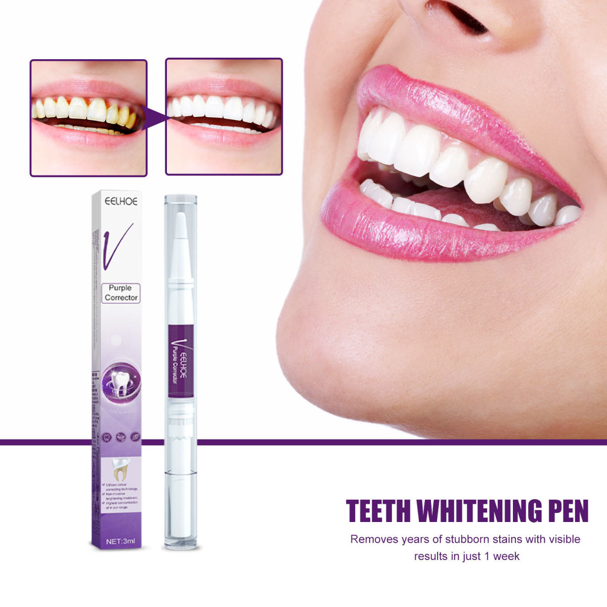 EELHOE V34 Purple Toothbrush Oral Cleaning Tooth Cleaner, Stain Removal, Radiant Teeth, Oral Care Tooth Pen