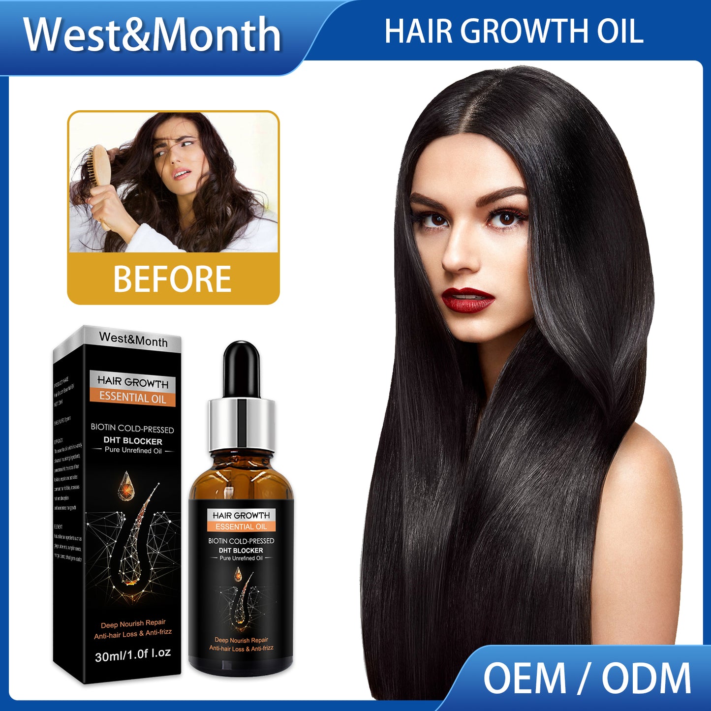 West&Month Hair Growth Essential Oil, Dense Hair Growth Repair Dry Hair And Moisture Hair Essence