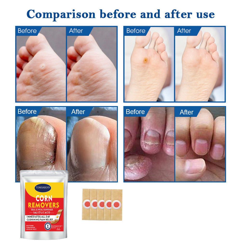 Foot Care Corn Removal Cream Set
