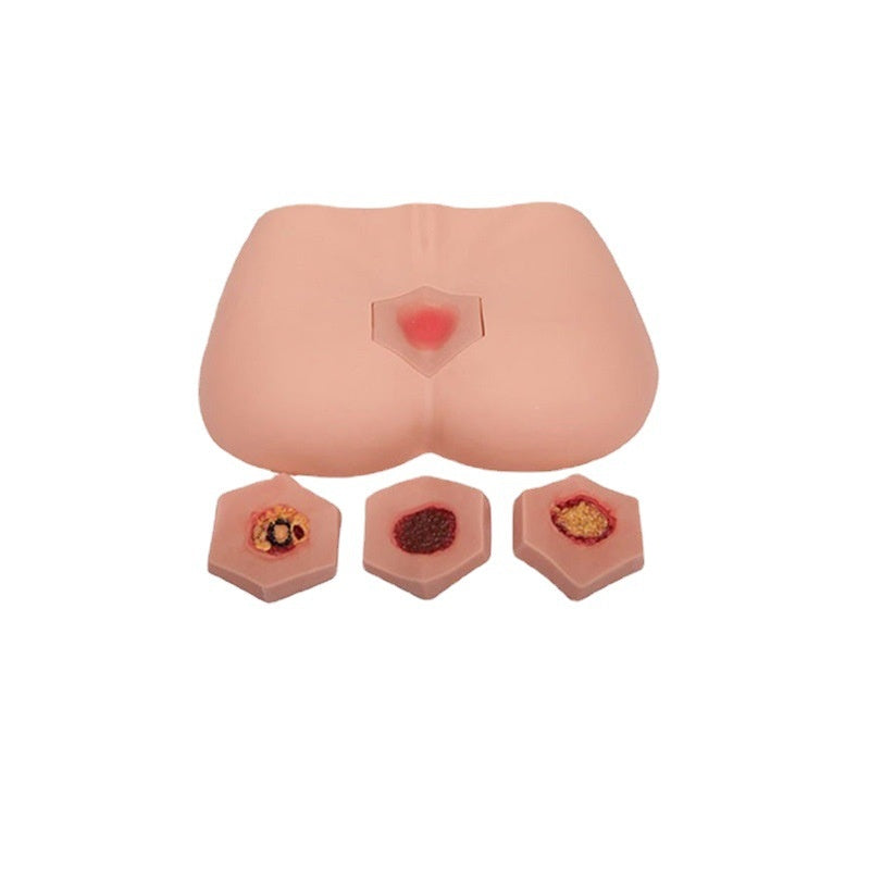 Stage Pressure Ulcer Care Model