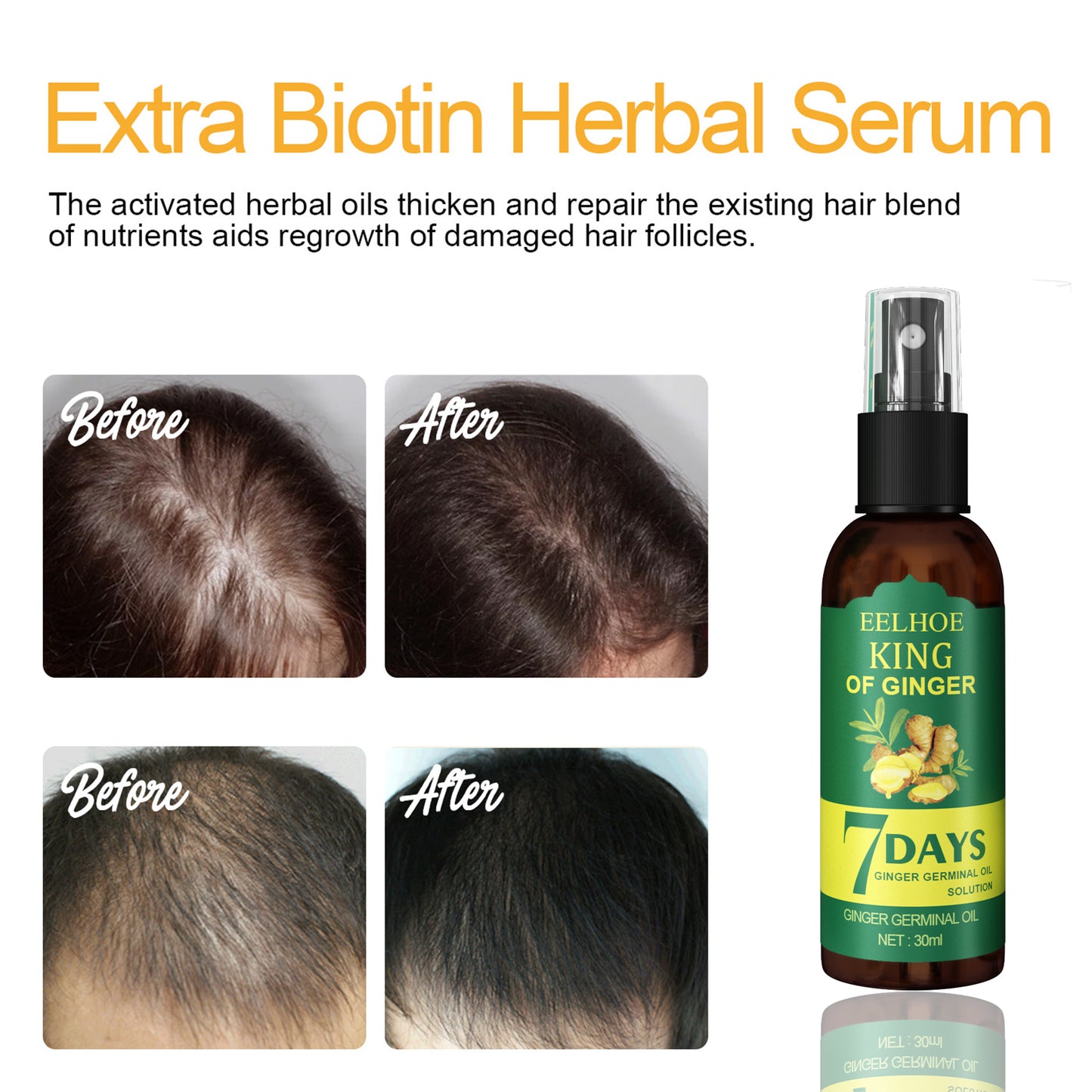 EELEelhoe Ginger Hair Spray, Strengthens Hair, Massages Scalp And Restores Hair