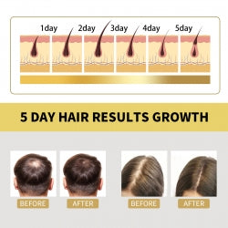 OUHOE Ginger Dense Hair Shampoo, Moisturizes Reduces Itchiness, Strengthens Dense And Fluffy Hair Care Shampoo