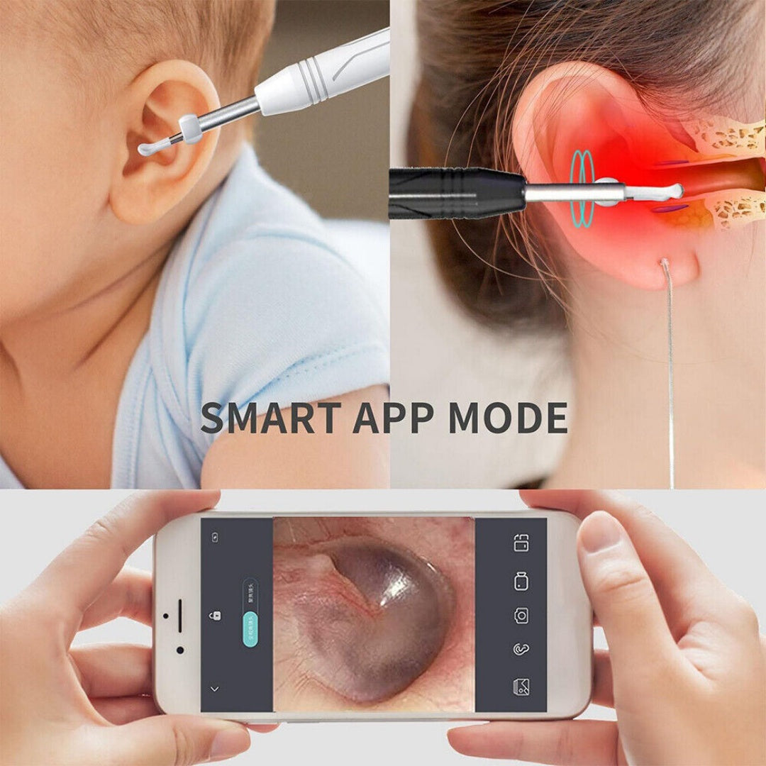 Smart Visual Earpick Ear Wax Removal Cleaner WiFi Ear Stick Endoscope Camera AU-black