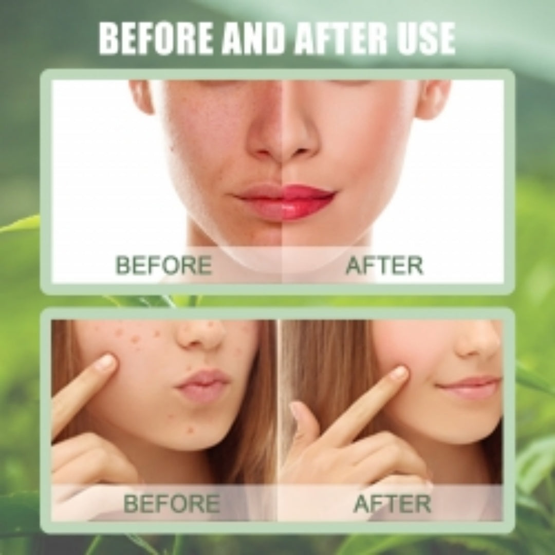 OUHOE Green Tea Mask Stick, Acne Blackheads Pimple Face Cleansing And Pore-Tightening Smear Mask Clay