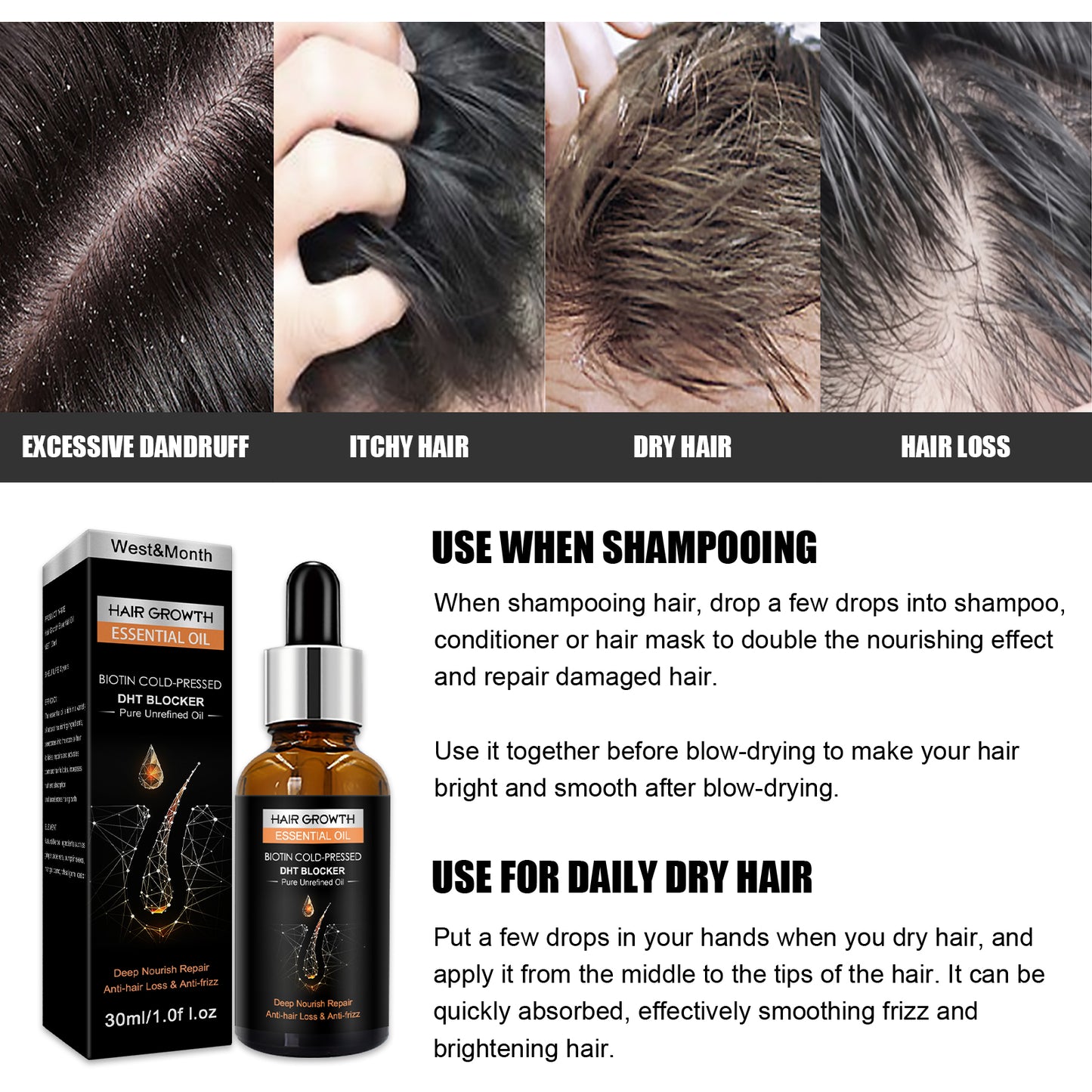West&Month Hair Growth Essential Oil, Dense Hair Growth Repair Dry Hair And Moisture Hair Essence