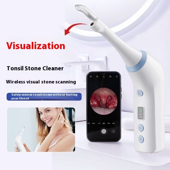 Visual Electric Stone Device Oral Cleaning Care Tool Stone Remover