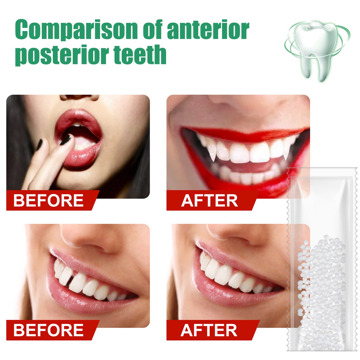 EELHOE Solid Dental Glue, Film And Television Makeup Denture Modification Temporary Fillings Dental Glue False Fillings Holes And Gaps