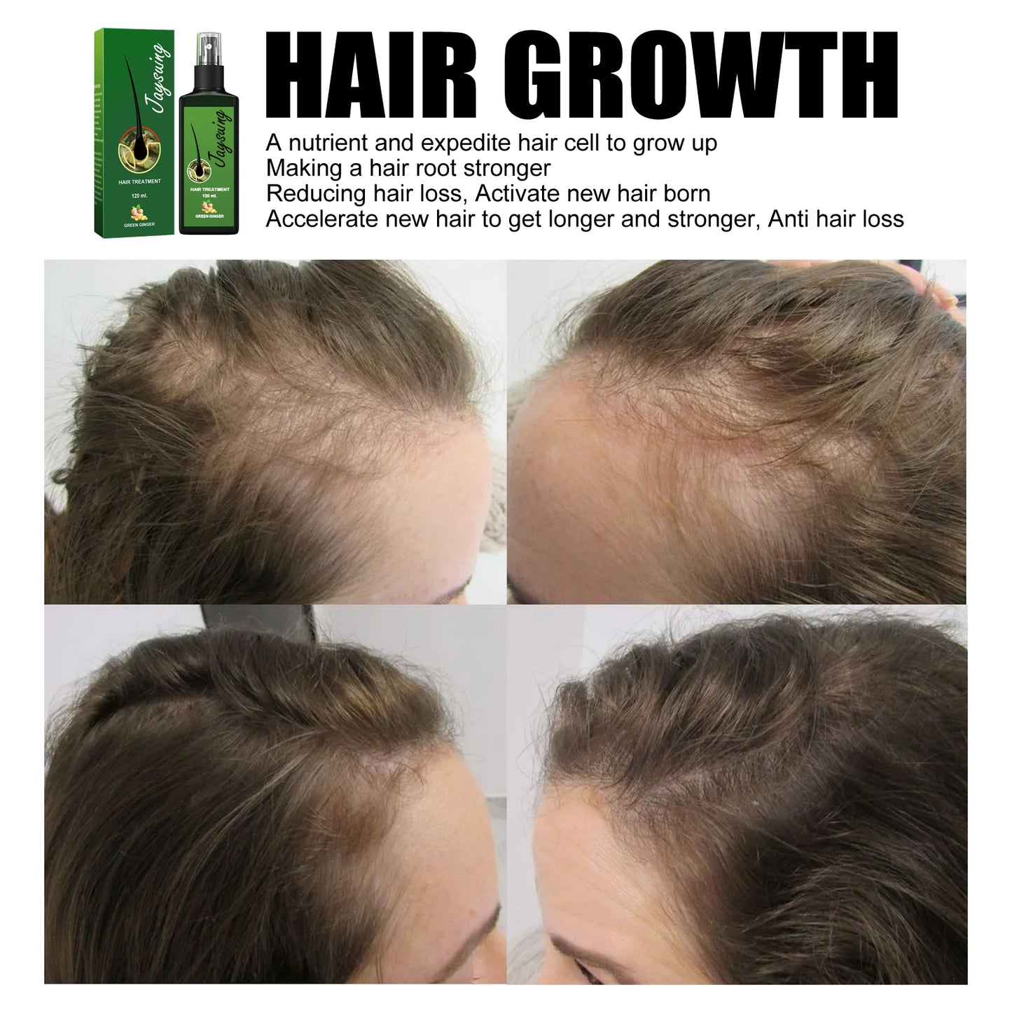Jaysuing Hair Treatment, Strengthens Hair, Nourishes Root Growth And Thickens Scalp Massage Nutrient Solution