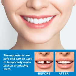 Jaysuing Moldable False Teeth, Film And Television Makeup Dentures Modified Dentures False Dentures Broken Teeth Temporary Dentures